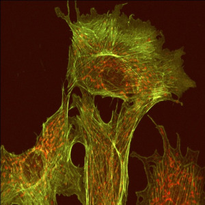 Microtubules (green) © Tina Carvalho