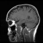 Brain MRI 370098_1349