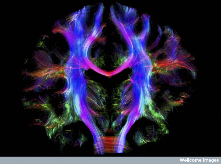B0010280 Healthy human brain from a young adult, tractography
