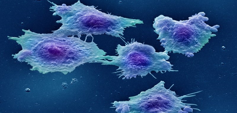 Cancer cells-crop