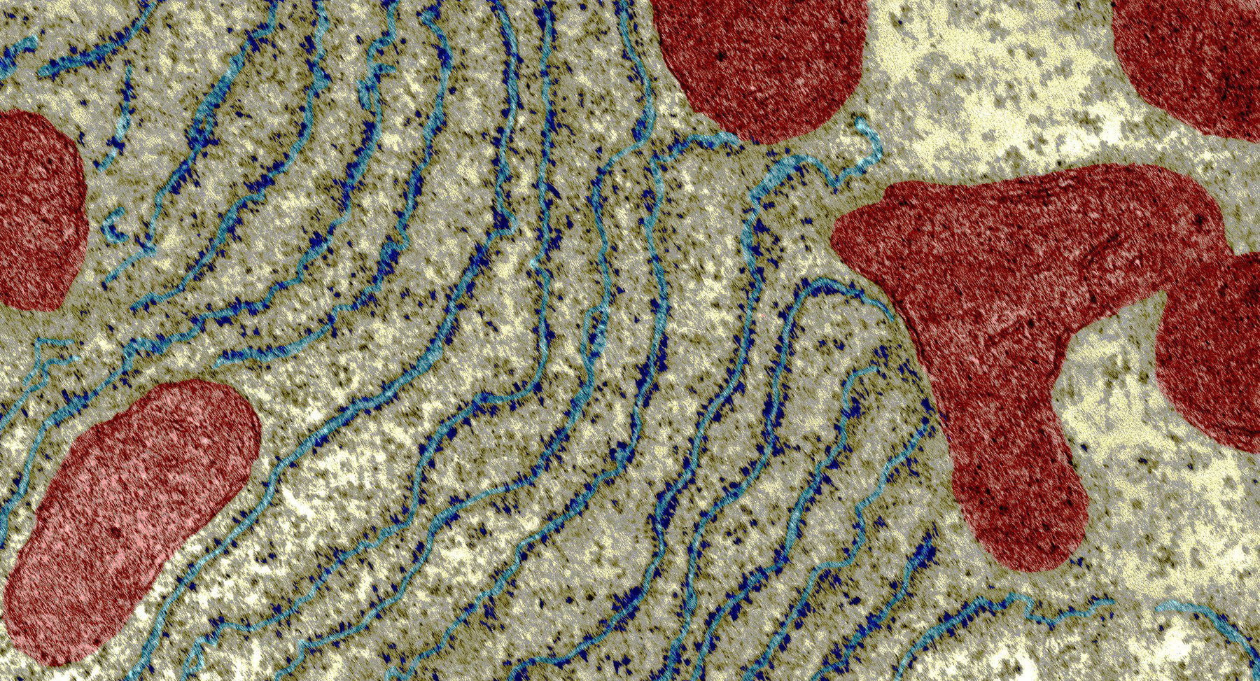 B0004157 Organelles within a liver cell