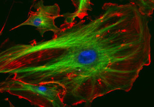 Cells, stained to show the inner skeleton (green)