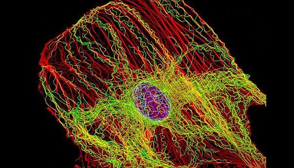 Fluorescent_image_fibroblast-crop