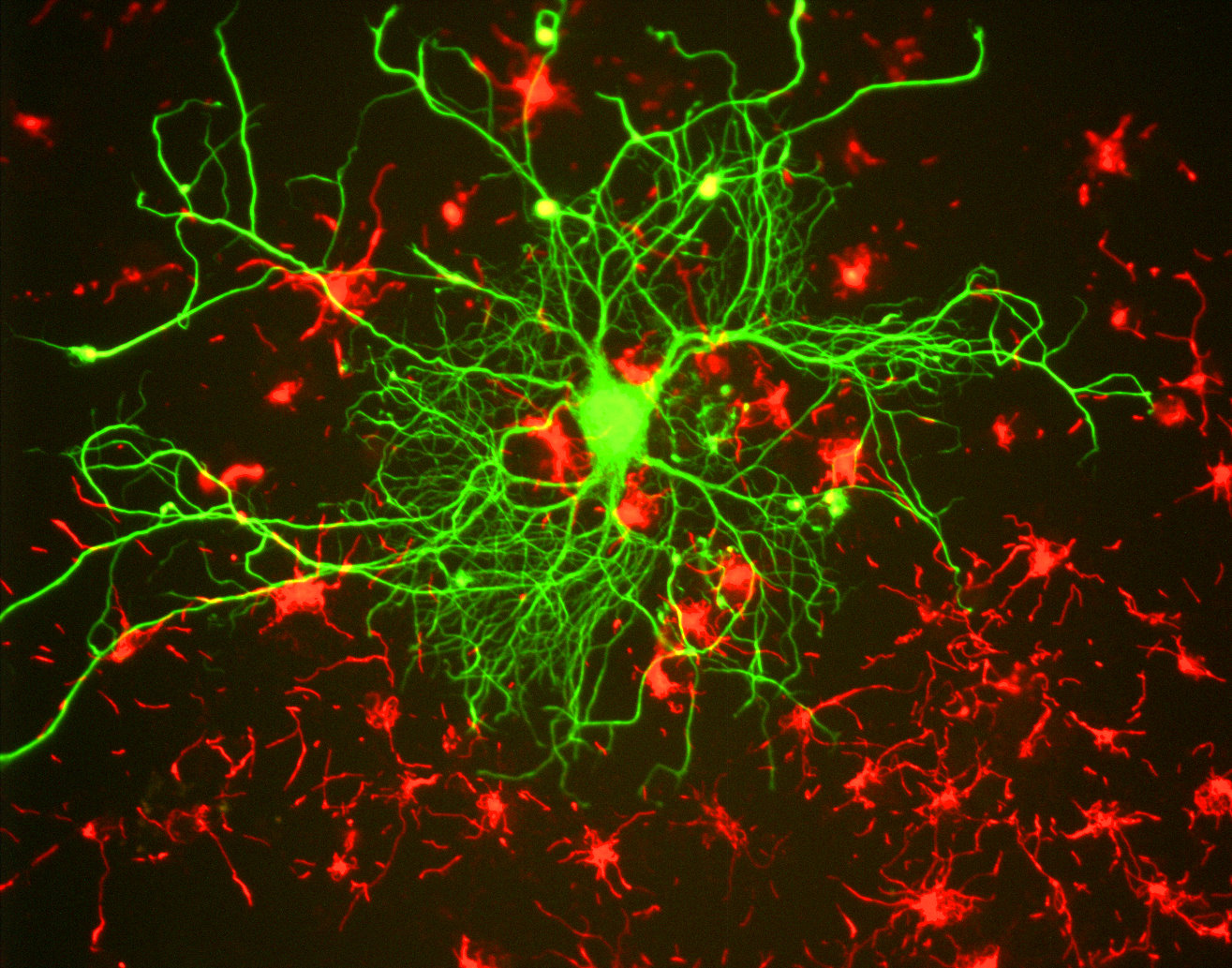 Neuron_in_tissue_culture (1)